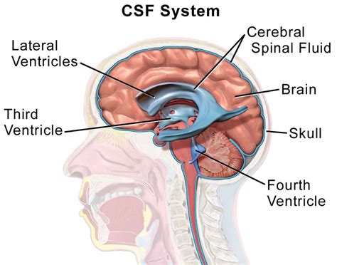 liquorverlustsyndrom|Cerebrospinal Fluid Leak: When Are Symptoms。